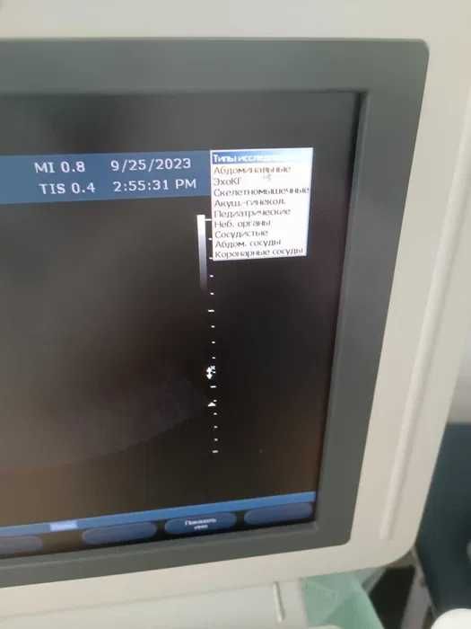 УЗД аппарат експертного класу Philips HD11XE