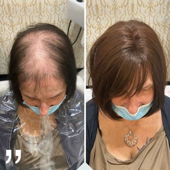 Curso Profissional de prótese capilar injetada em Alverca