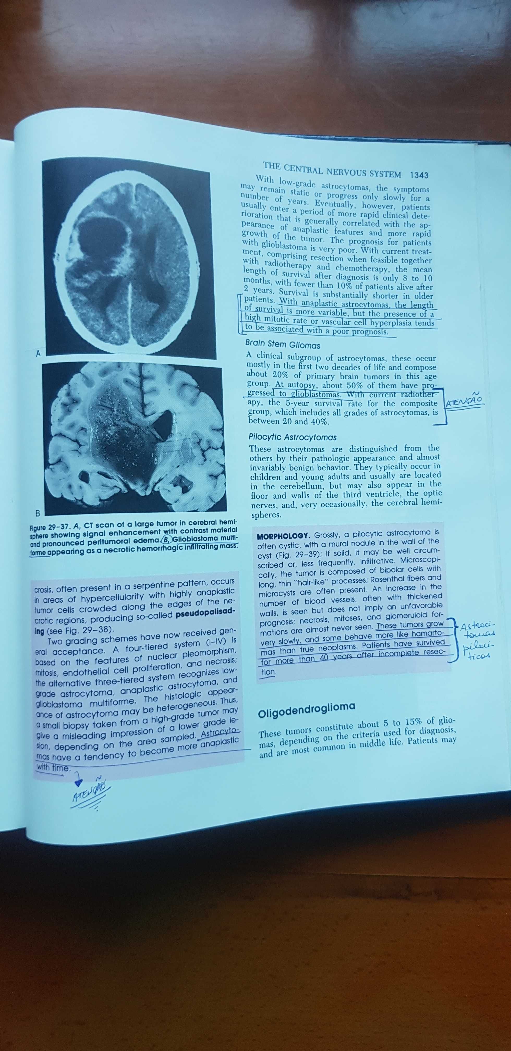 Robbins pathologic basis of disease