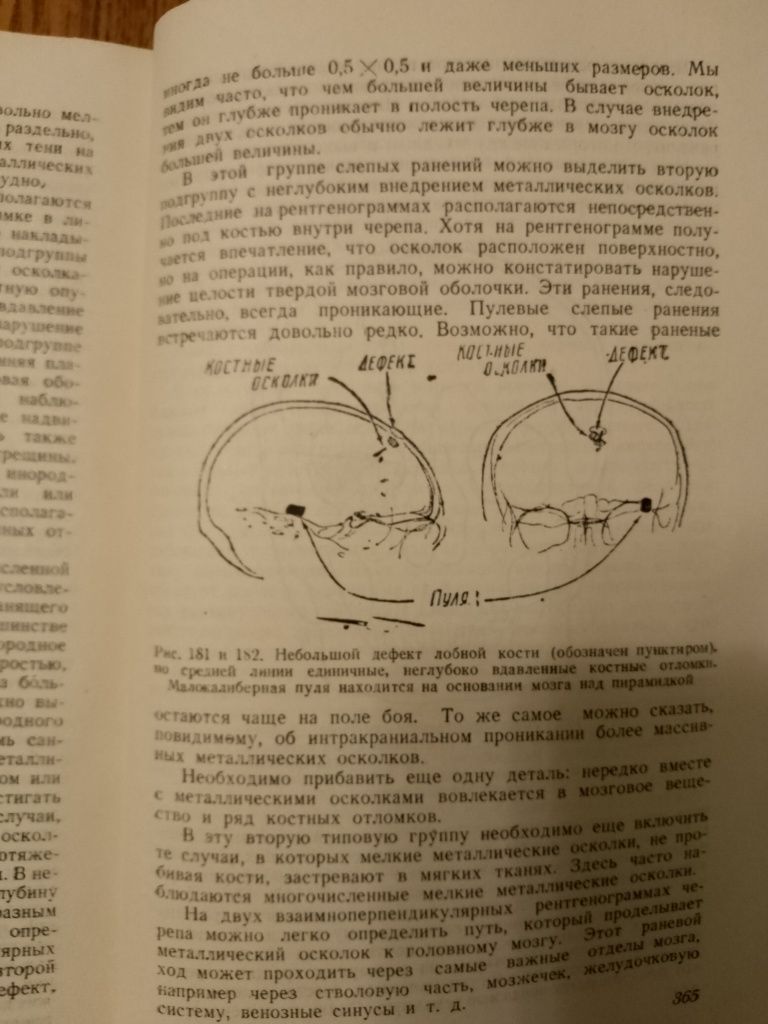 А.В.Бондарчук,"Основы военно-полевой нейрохирургии" 1942