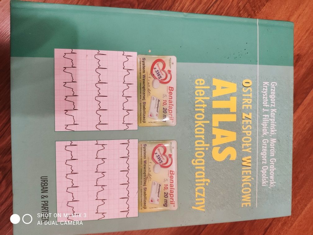 Atlas elektrokardiografii Ostre zespoły wiencowe