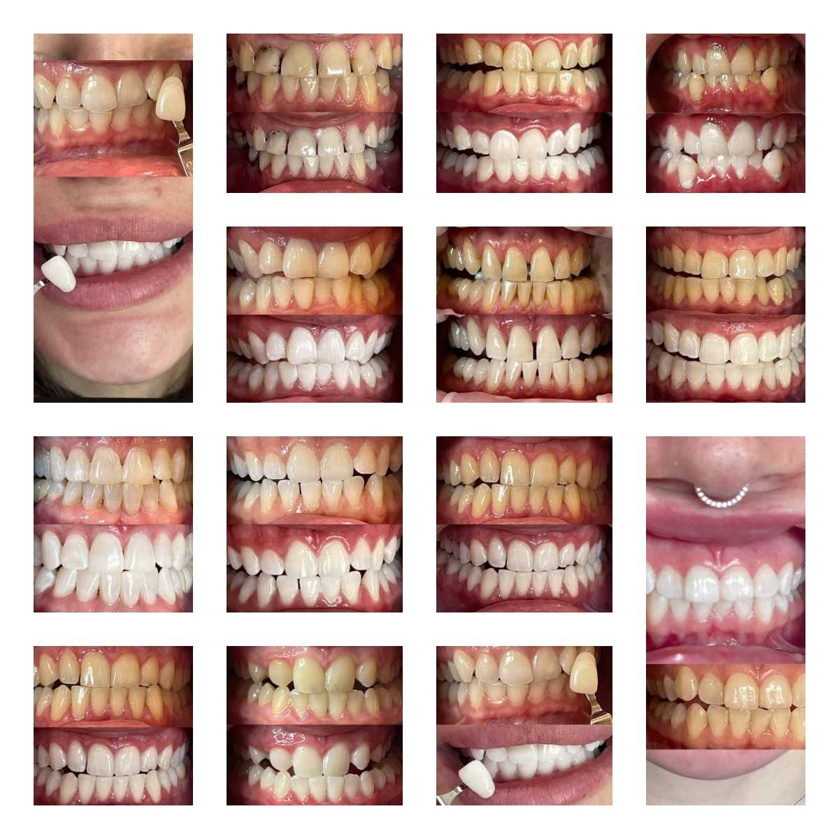 Франшиза сети студий косметического отбеливания зубов Smile LAB