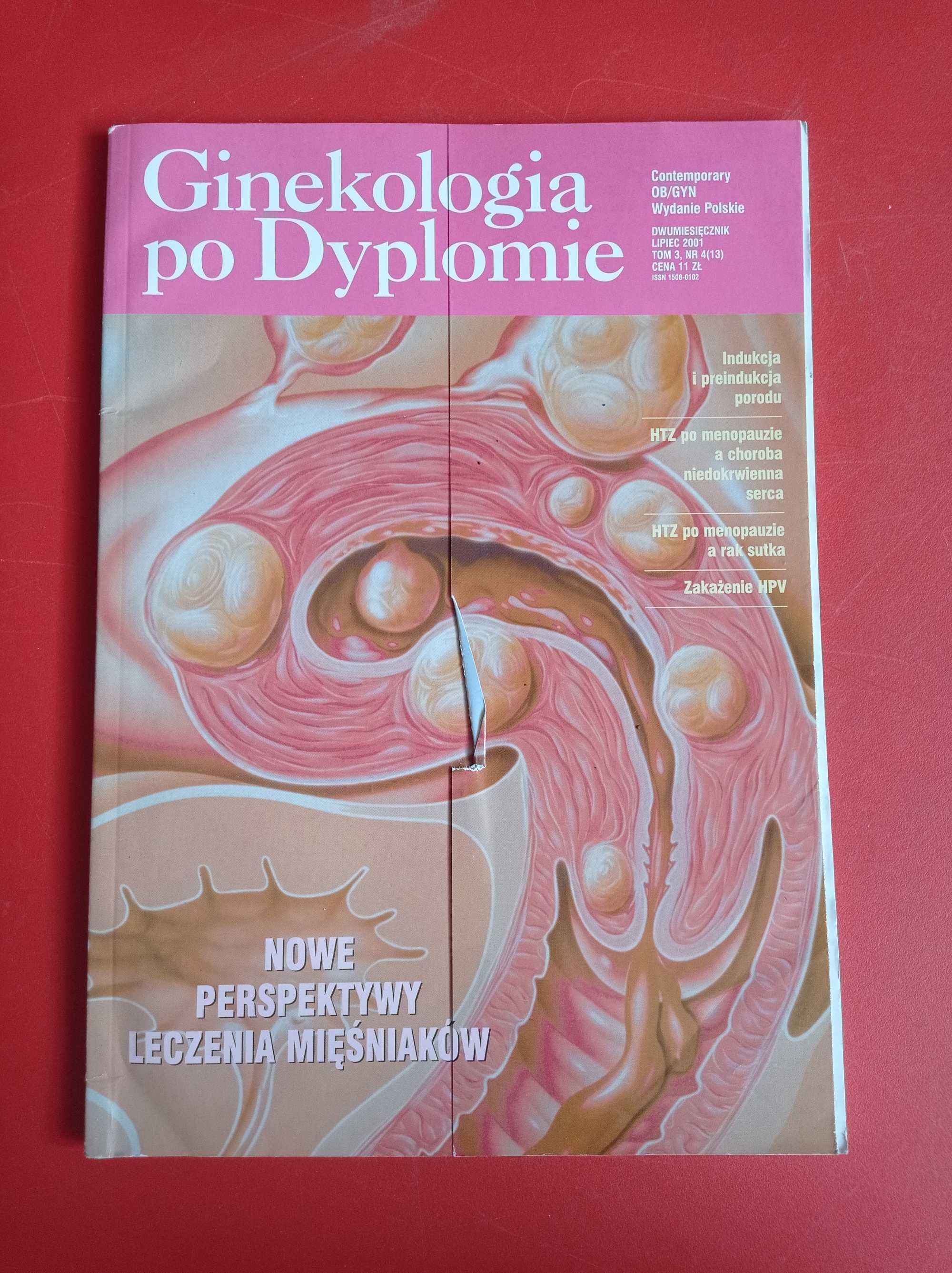 Ginekologia po dyplomie, nr 4, tom 3, lipiec 2001