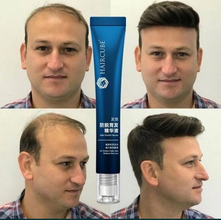 Корейський засіб для росту і проти випадіння волосся