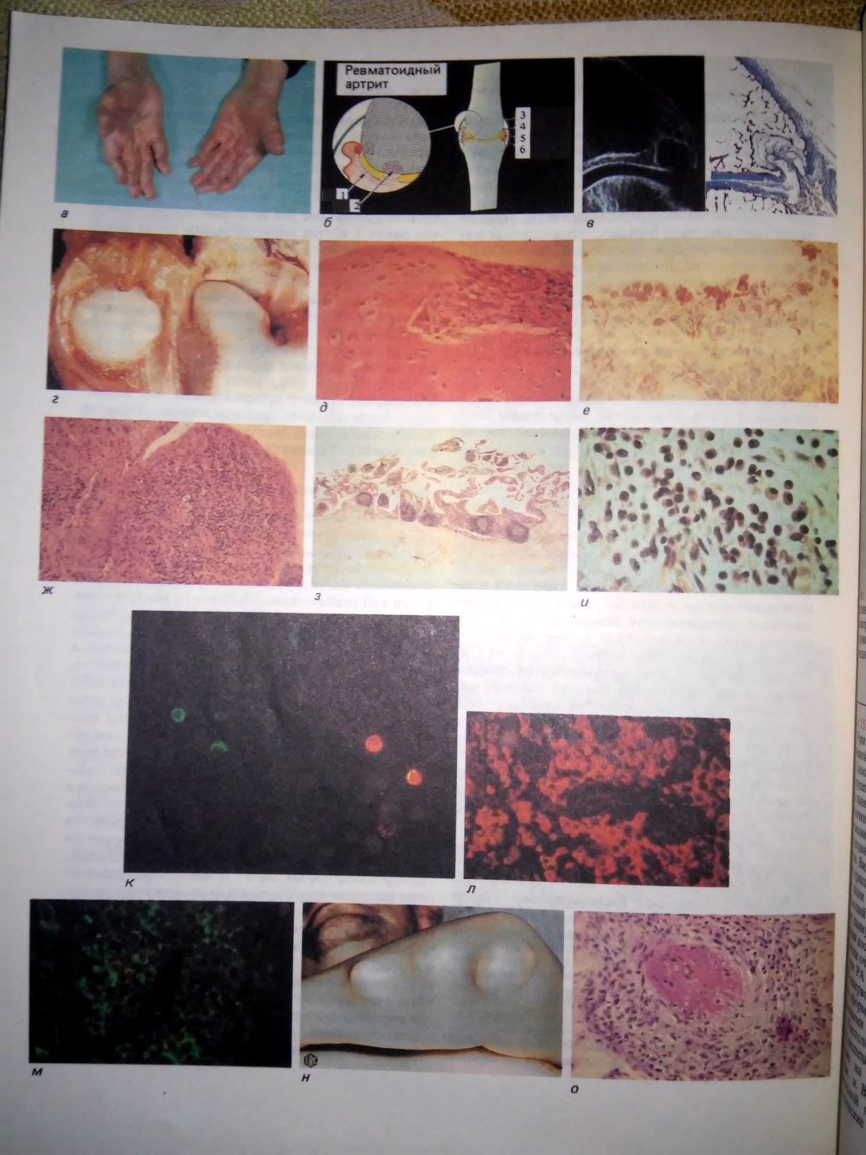 Ройт Основы иммунологии 1991