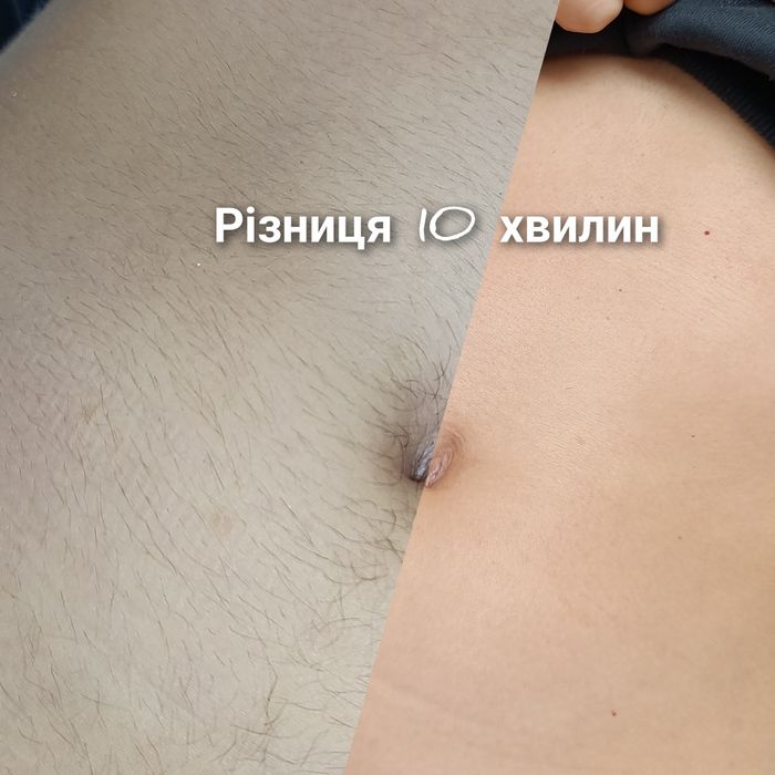 Безкоштовно моделі на шугаринг, воскову депіляцію