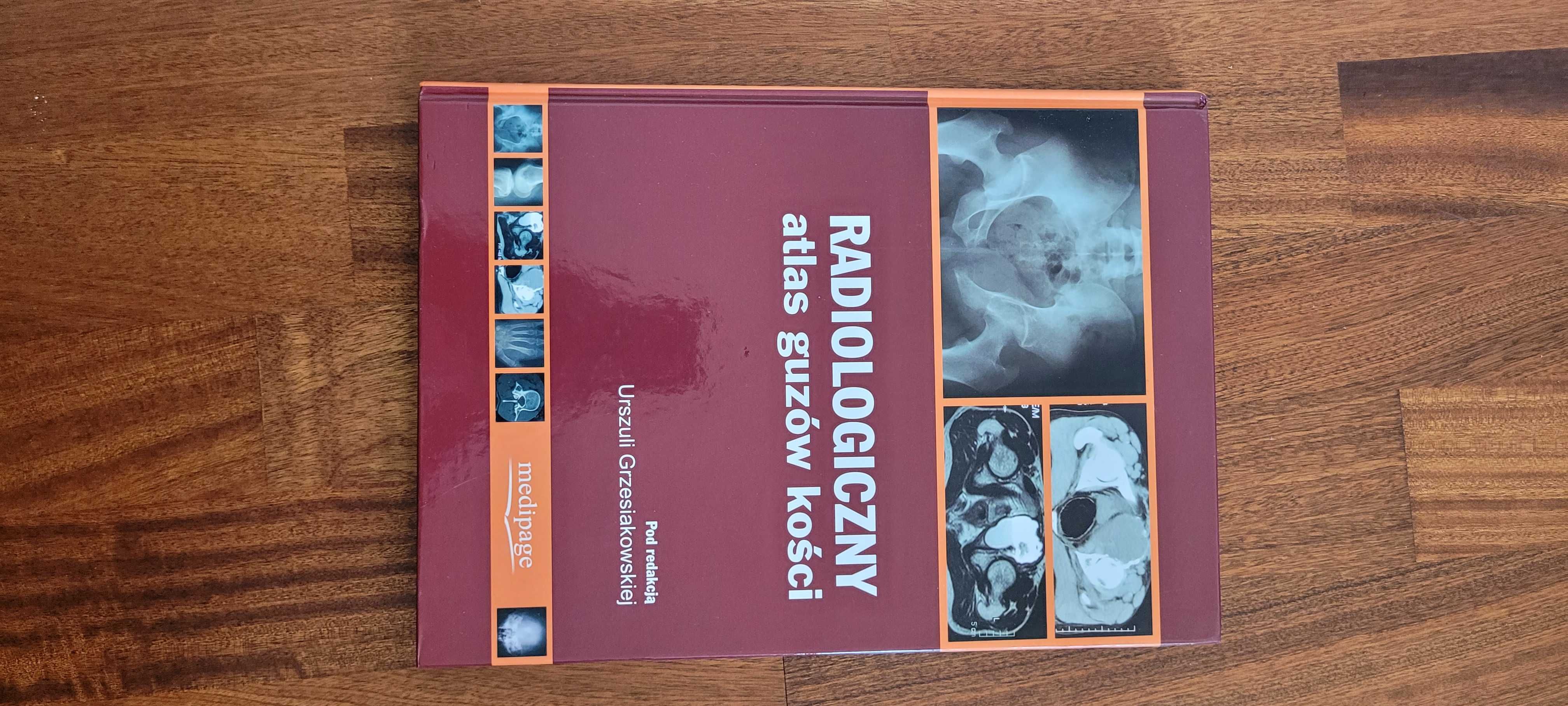 Radiologiczny atlas guzów kości Urszula Grzesiakowska