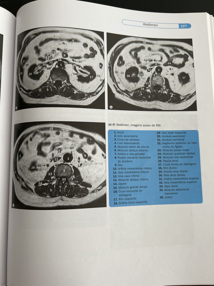 Atlas de Anatomia Humana em Imagem 3ªEdicao