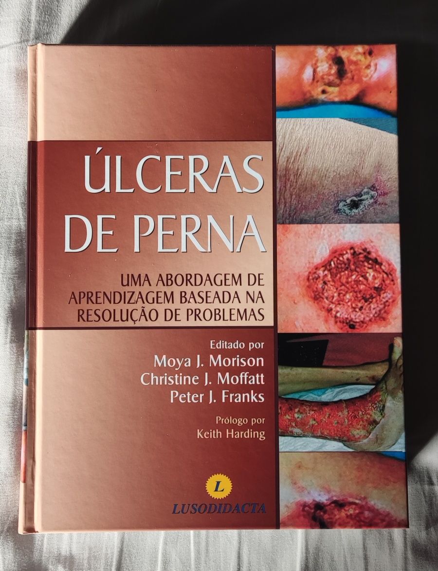 Úlceras de perna