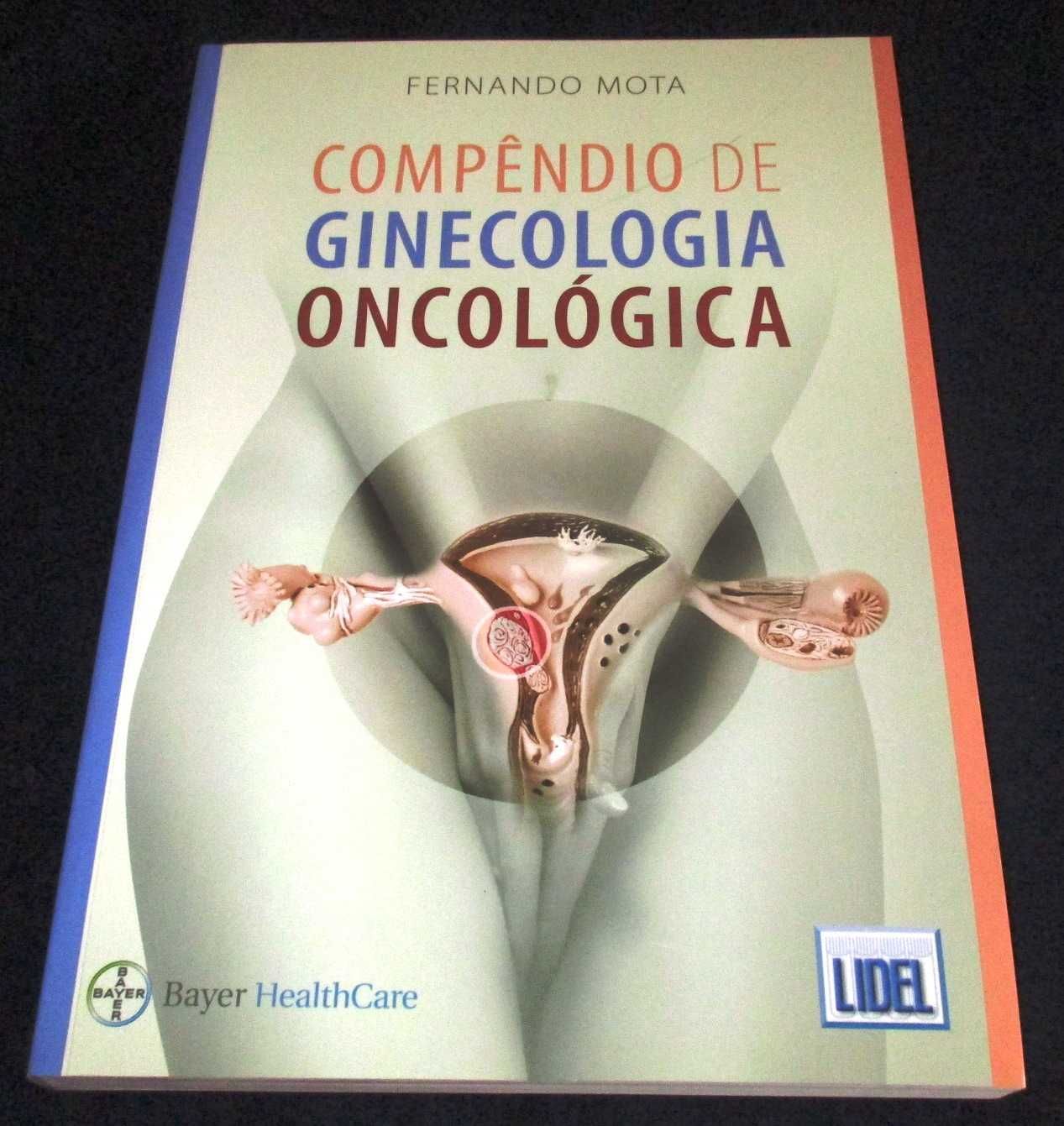 Livro Compêndio de Ginecologia Oncológica Fernando Mota