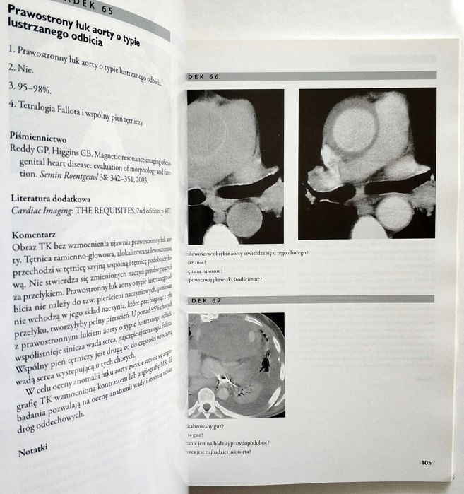 Diagnostyka obrazowa SERCE. Przypadki kliniczne, Reddy, Steiner, NOWA!