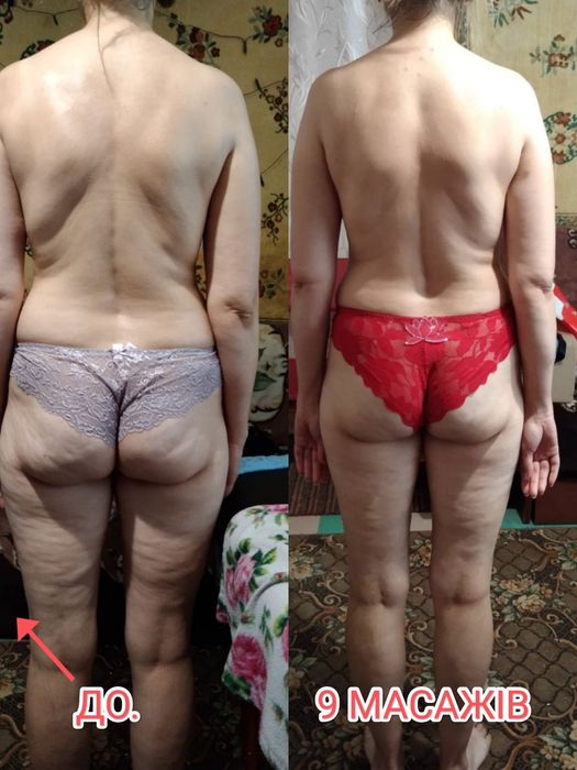 Костоправ. Масажист. Реабілітолог.Вісцеральний тарапевт. Масаж обличчя