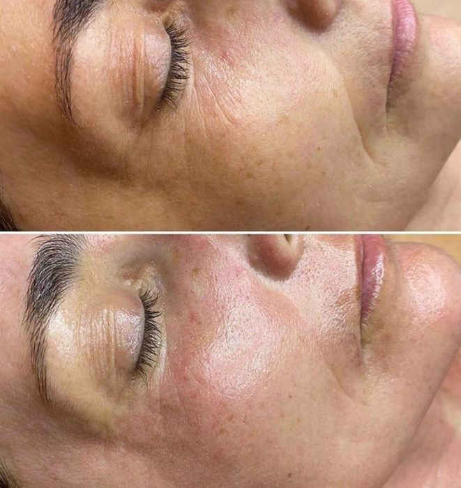 Массаж лица, Массаж, Лечебный, Антицелюлитный, Днепр, Левый берег.