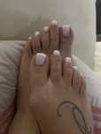 Pedicure completa e tratamento de fungos