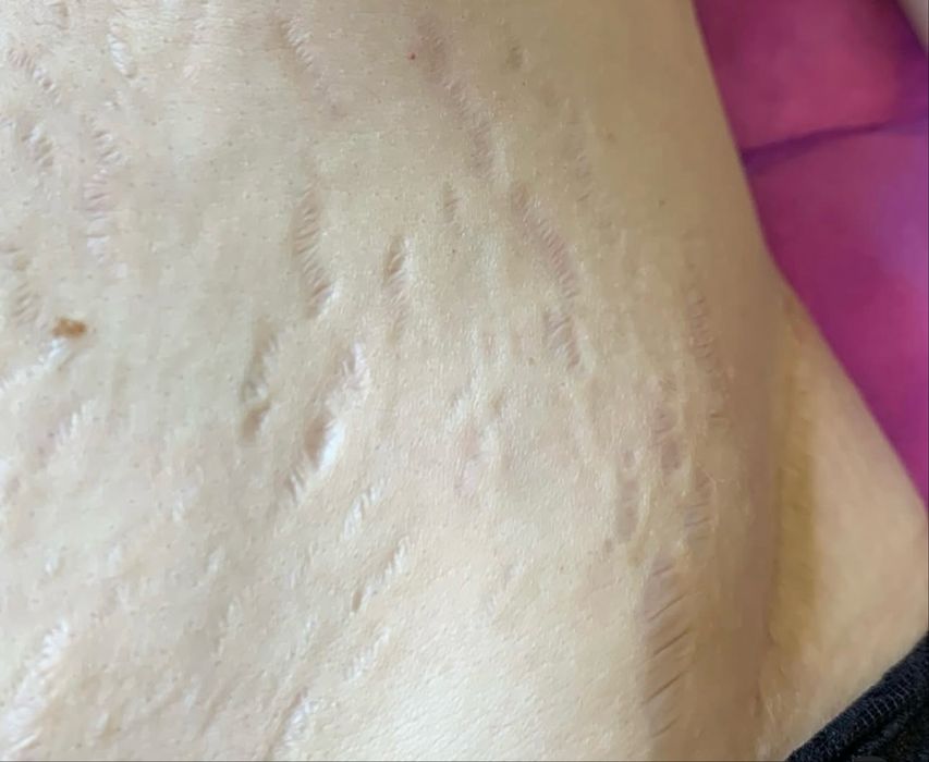 мікронідлінг з 0 до прфі курси