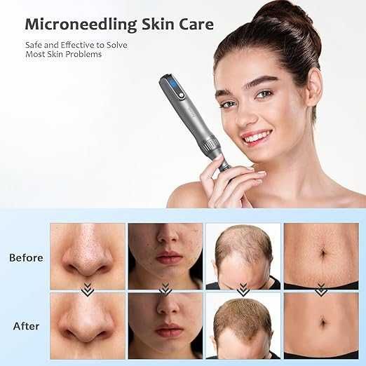 dermapen Pen do mikrodermabrazji + igła