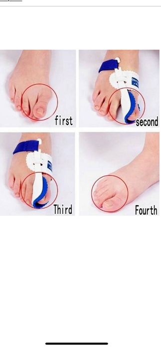 Ортопедична вальгусна шина бандаж