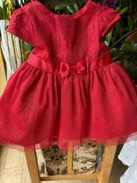 Sukienki dla małej dziewczynki +opaska gratis.