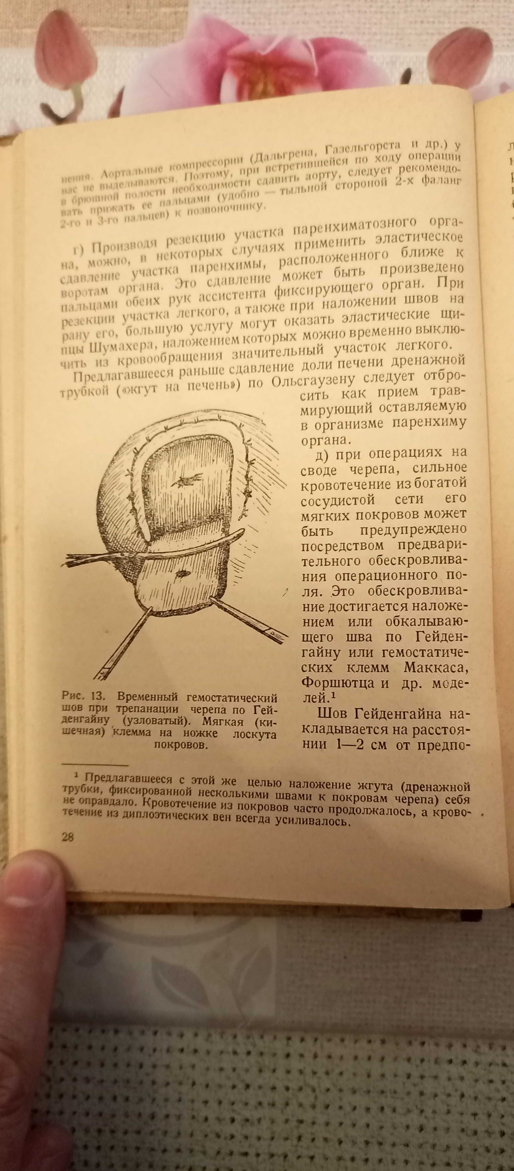 Левитский В.П., Кровотечение и методы его остановки. Книга, 1942 год.