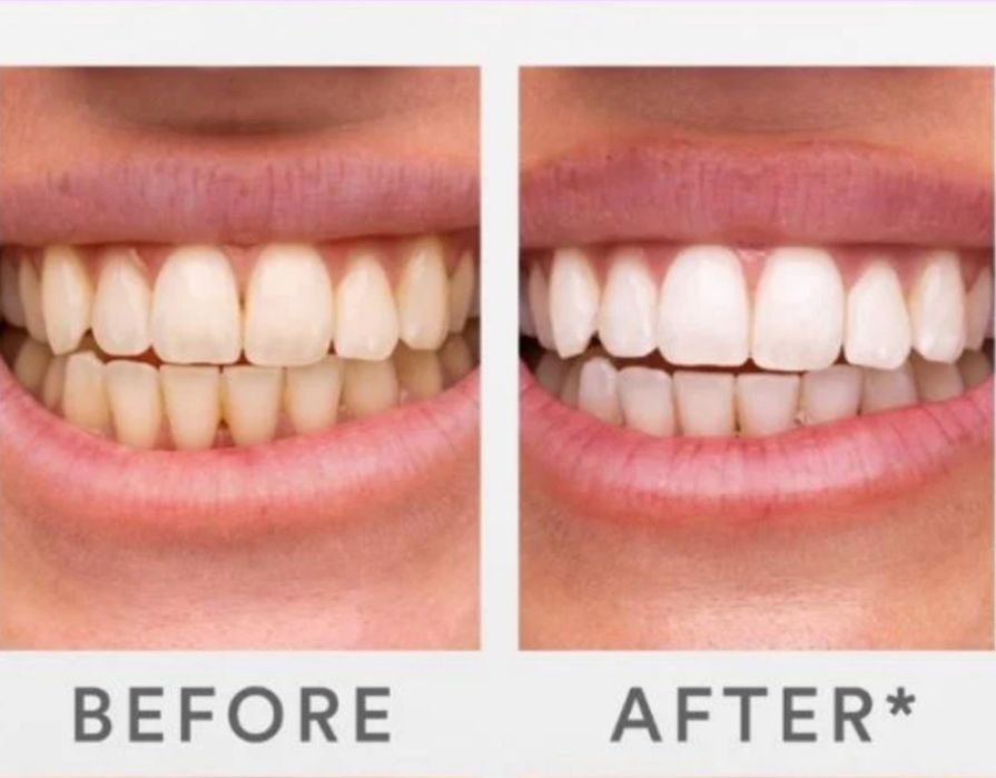 Korektor koloru zębów V34 HighSmile | Nowy, nieotwierany, 30 ml