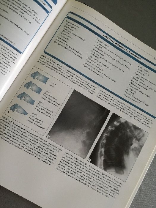 Atlas Endocrinologia Clínica