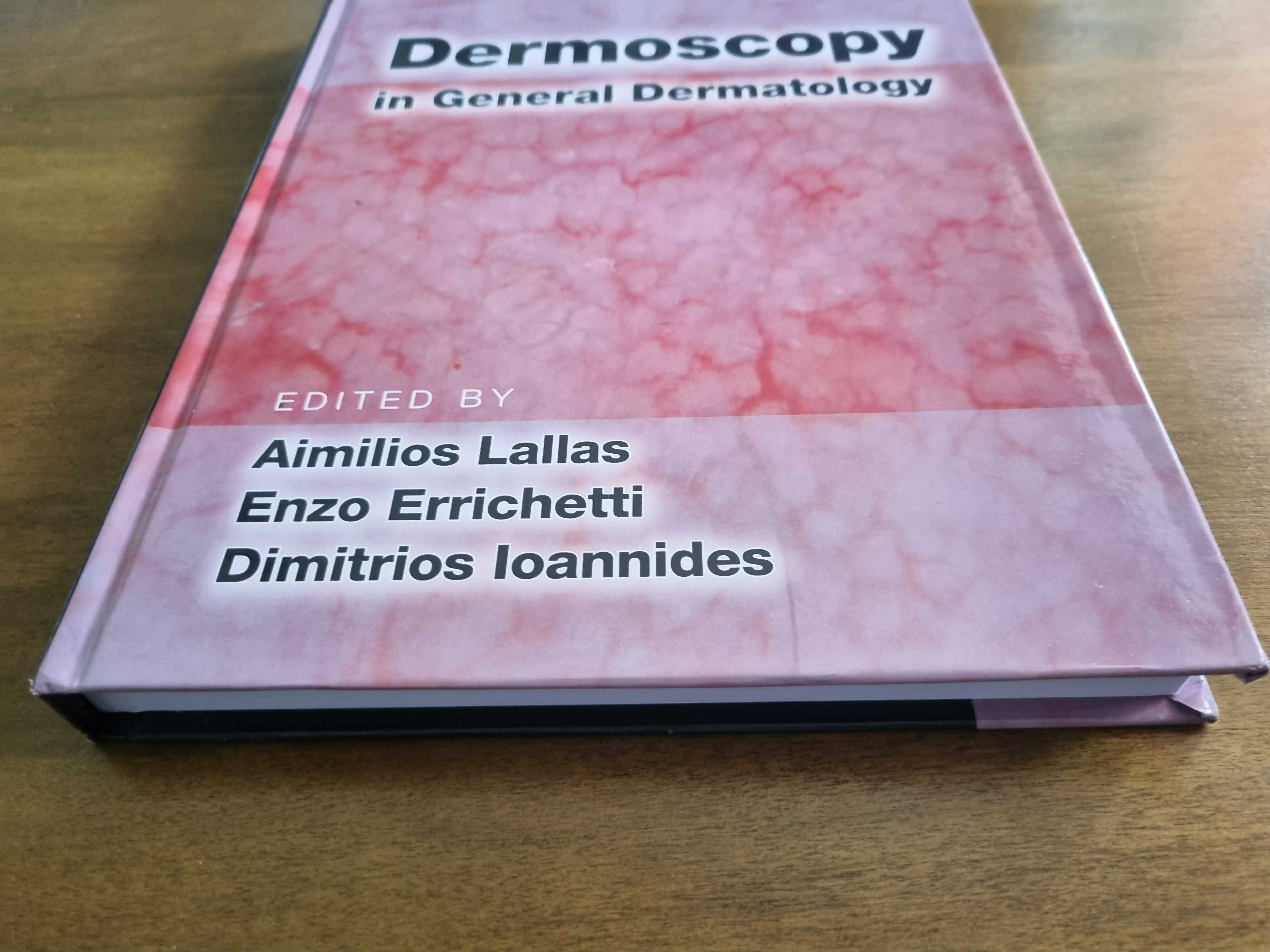 Nowa książka "Dermoscopy in general dermatology" Lallas Dermatoskopia