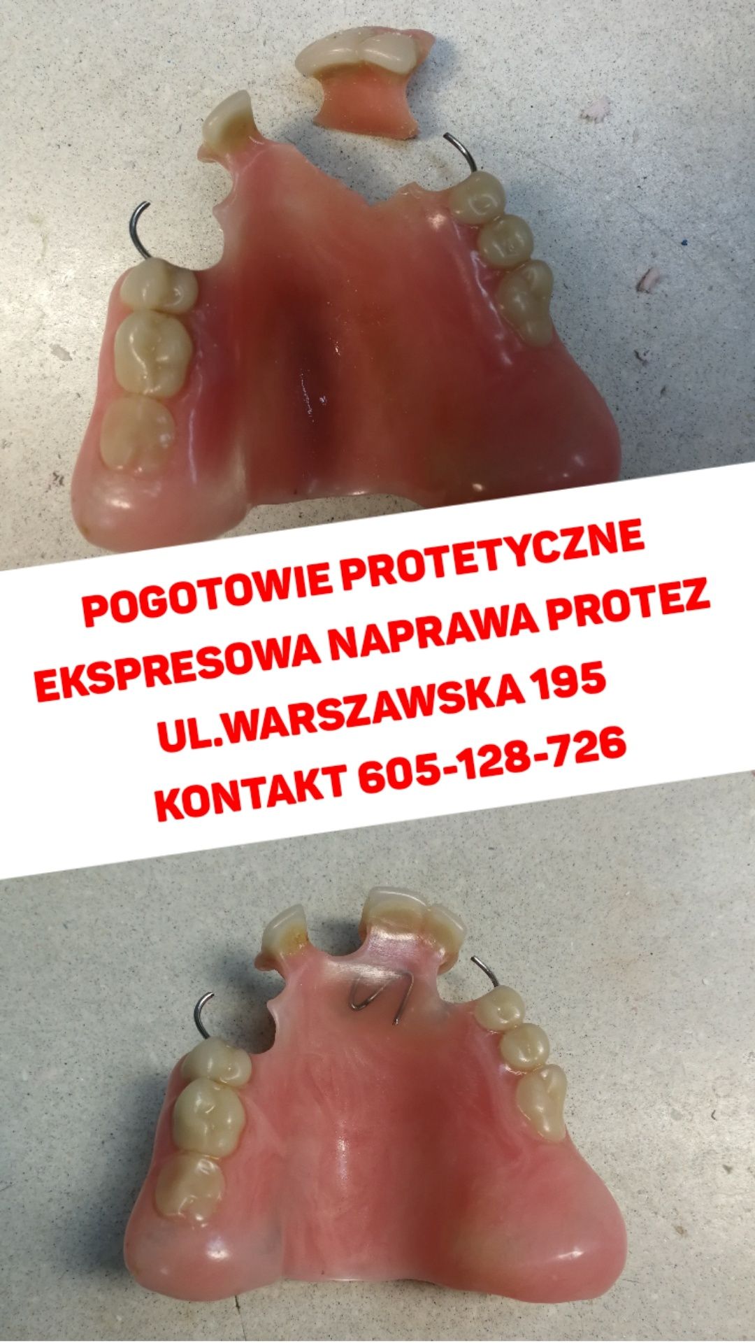 Ekspresowa Naprawa Protez. 7dni w tygodniu tel.605.128.726