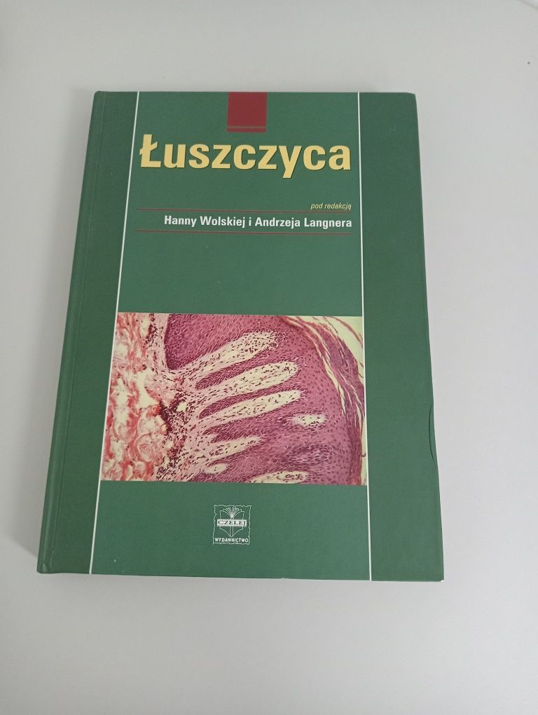 Łuszczyca podręcznik medyczny