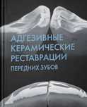 ЗАМОВЛЯЙ! Адгезивние керамические реставрации переданих зубов книга