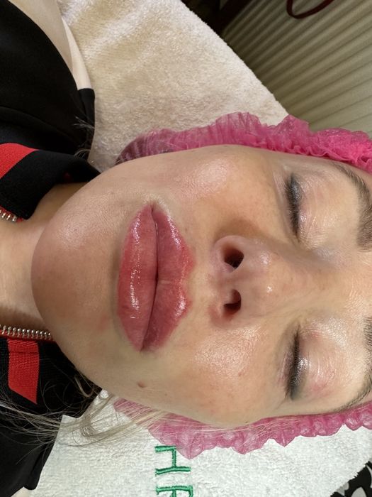 Косметолог Ужгород, інʼєкціоніст.