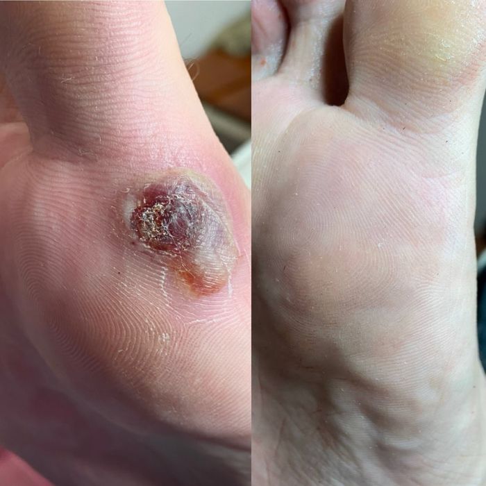 Подолог. Медичний педикюр