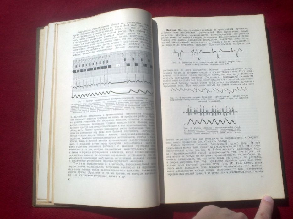 В.Ф. Зеленин. Болезни сердечно-сосудистой системы. 1956 г