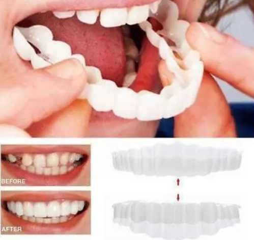 Виниры SnapOn Smile Veneers для верхних и нижних зубов