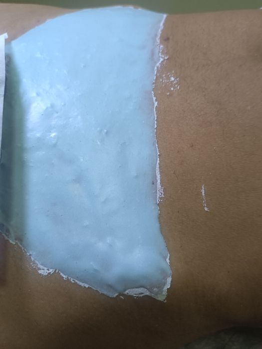 Чоловіча депіляція, видалення волосся для чоловіків на тілі та обличчі