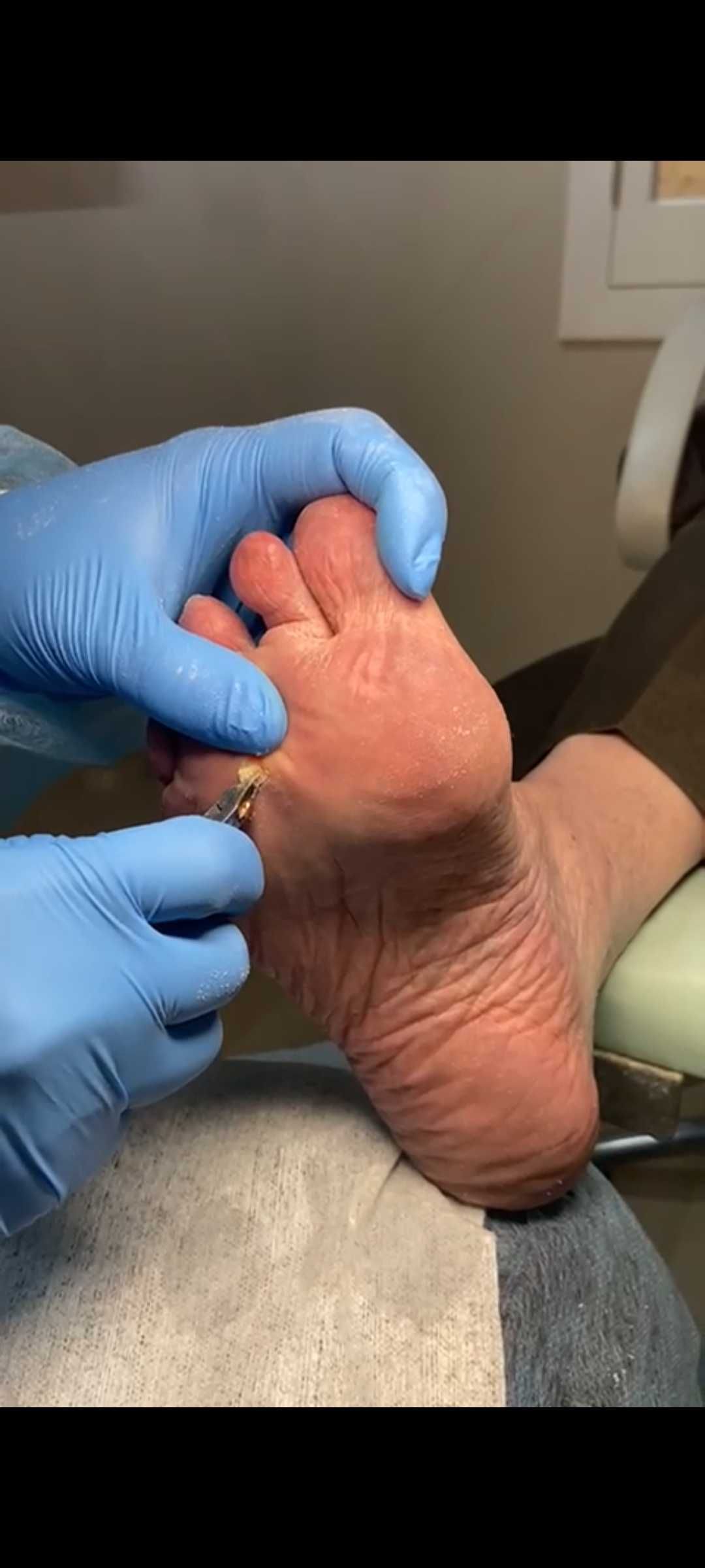 Pedicure medical