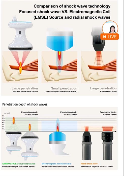 УВТ аппарат фокусированый пьезоэлектрический