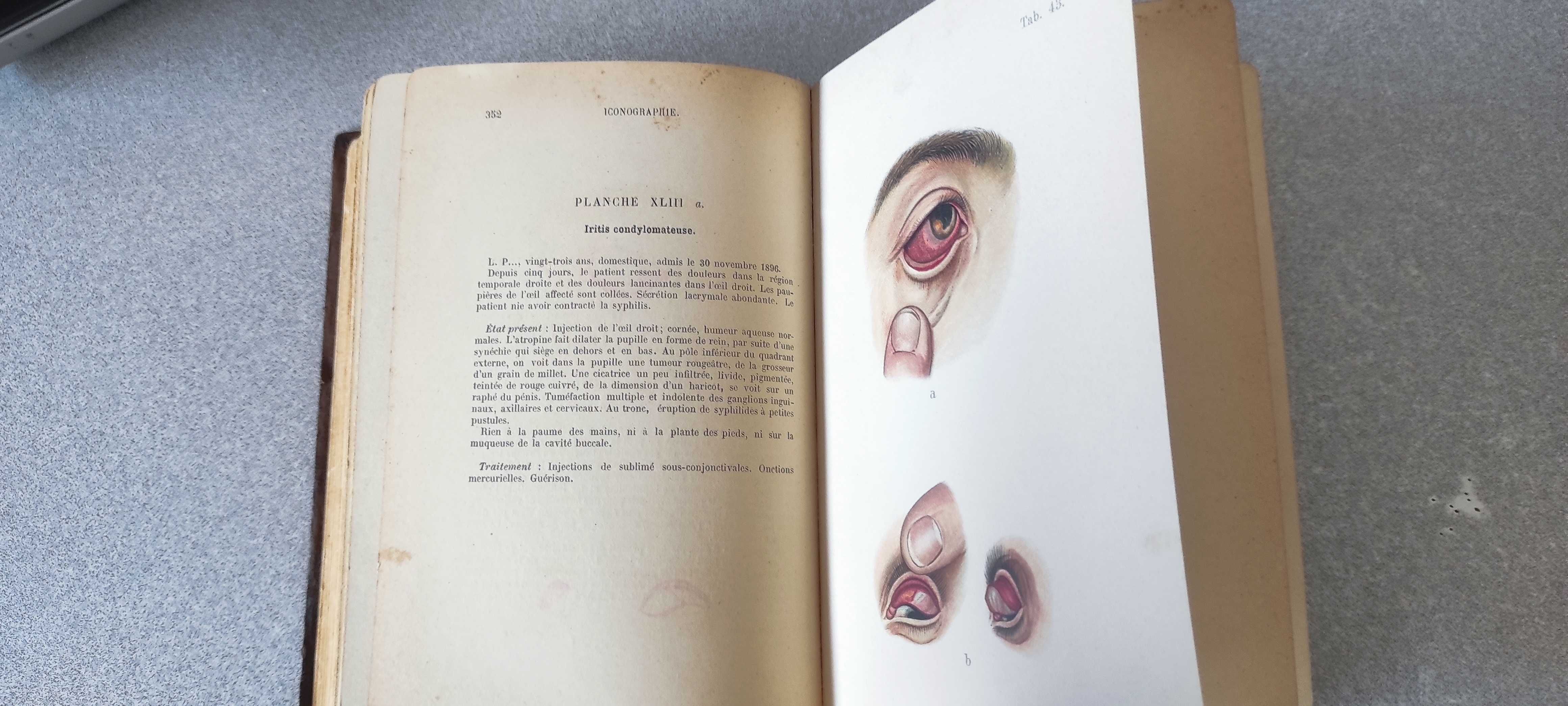 VENDO Livro raro - Mracek - Émery Atlas-Manuel des Maladies Vénérienne