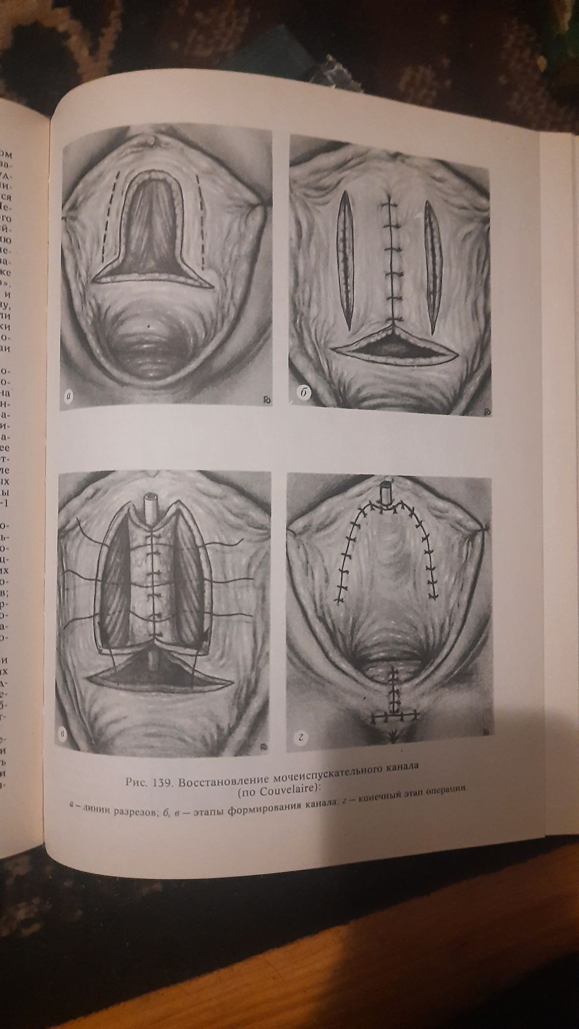 атлас урогинекологических операций Чухриенко