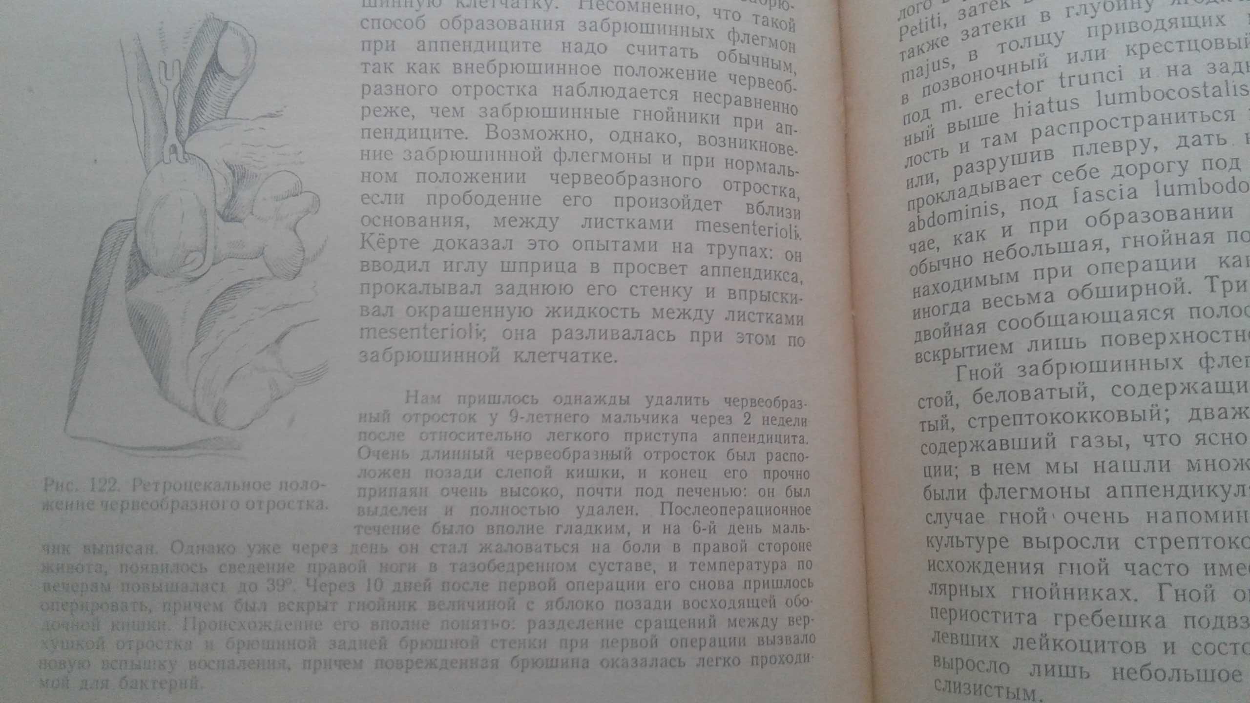 Очерки гнойной хирургии 1956 год В. Ф. Войно-Ясенецкий