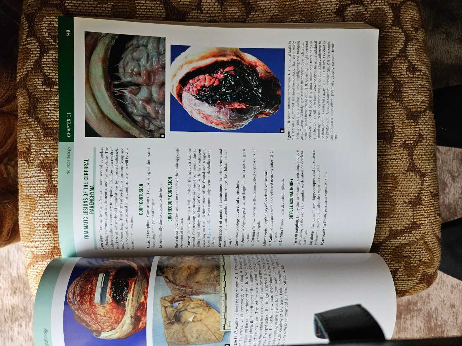 Pathology - Mange j.angielski