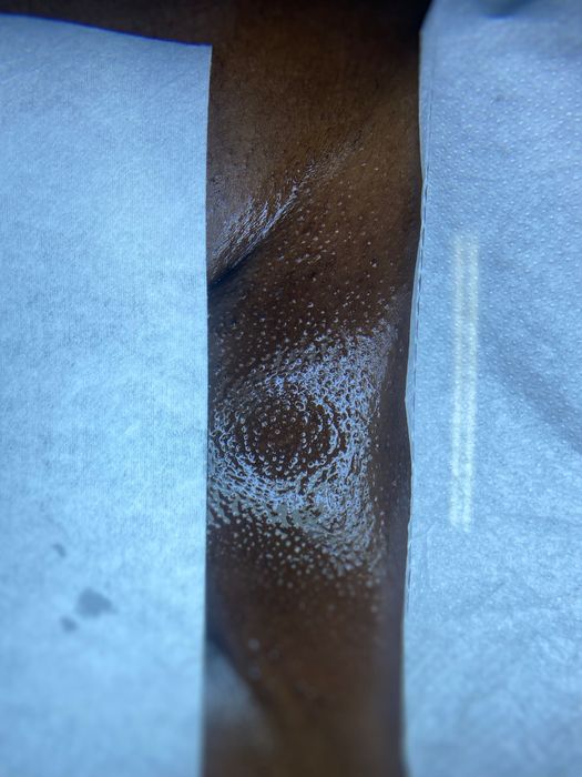 1. Depilação a cera e massagem ao domicílio – Porto e arredores.