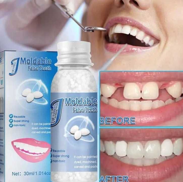 Клей для ремонта зубов, устройство для временного наполнения