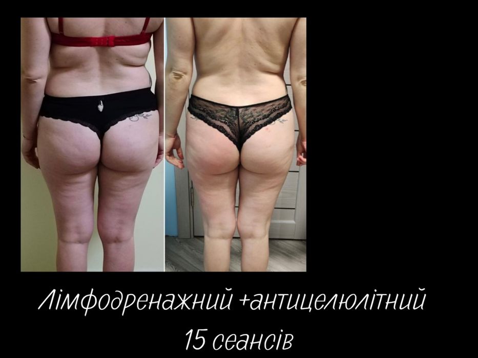 Масаж Київ. Оболонь. Мінська