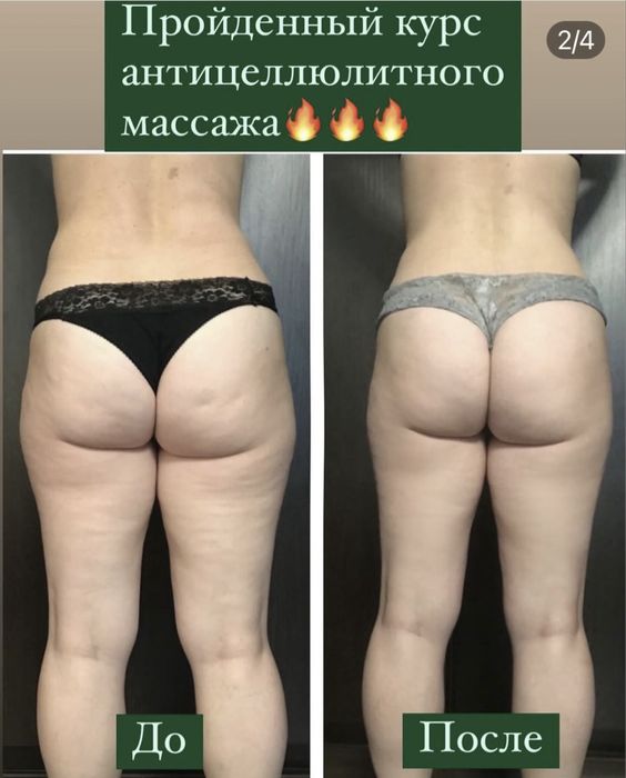 Массаж эпиляция. Только для женщин. Улица Гурова 17 ,салон Подиум