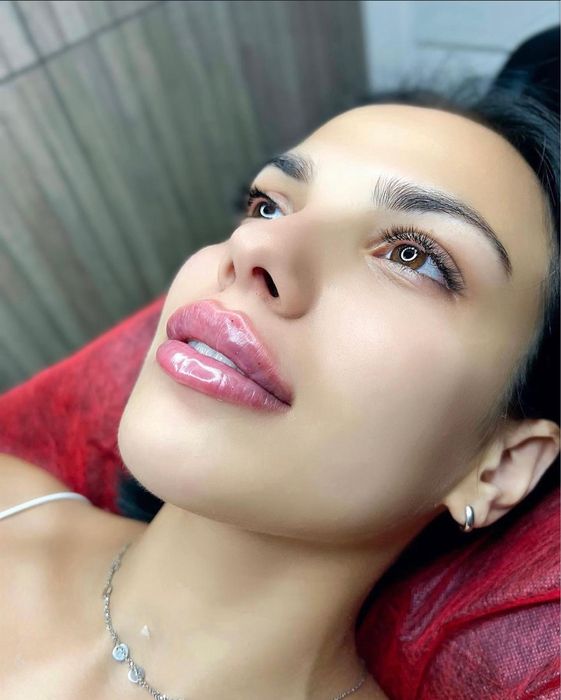 Увеличение губ, ботокс