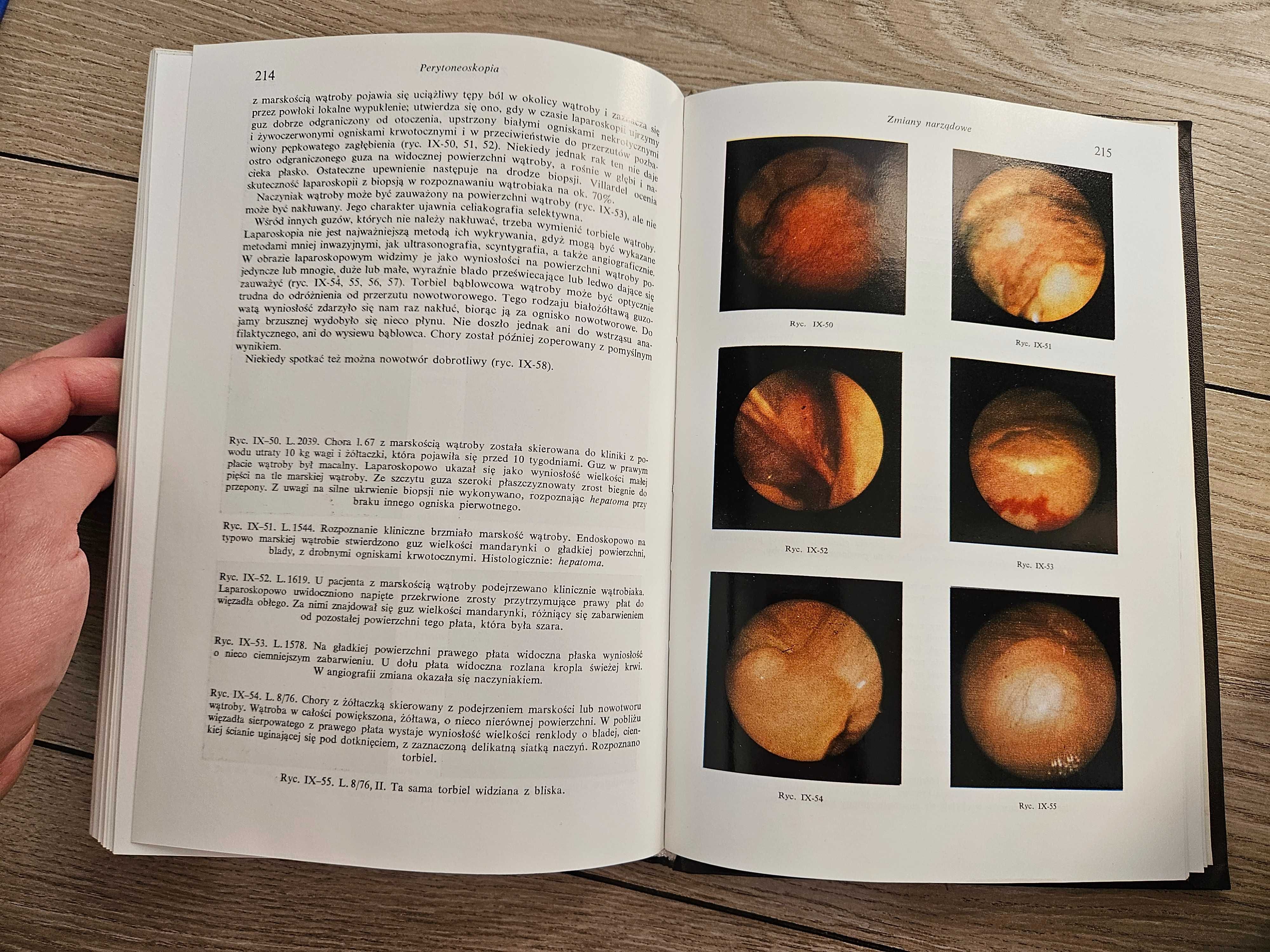 Endoskopia gastronterologiczna Gibiński