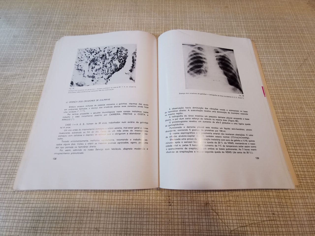 Livro Granulomatoses pulmonares