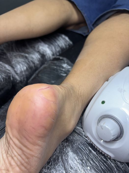 Дмитровка,Горишние плавни ,педекюр