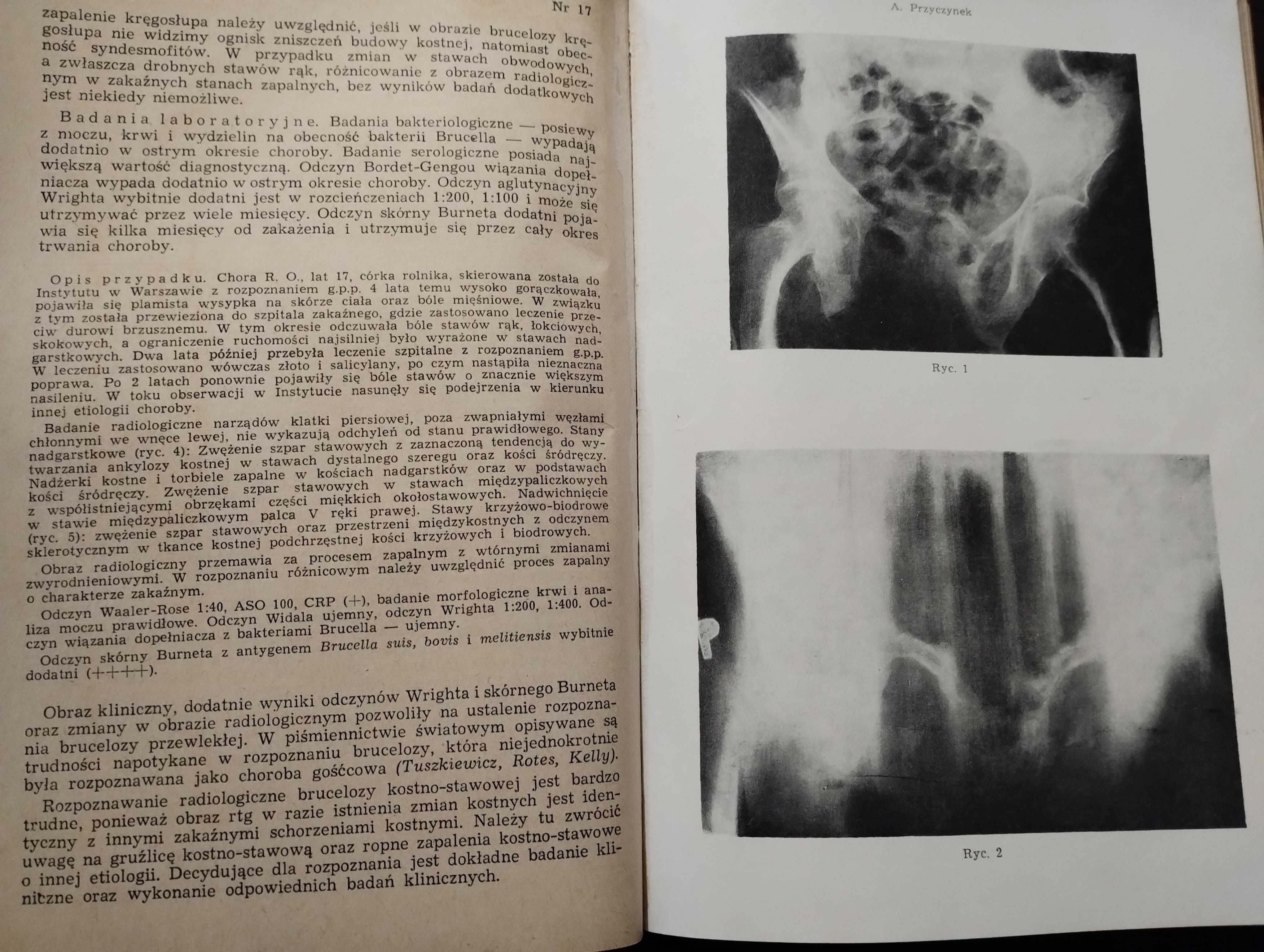 Wiadomości lekarskie 1965 Medycyna praktyczna Grott