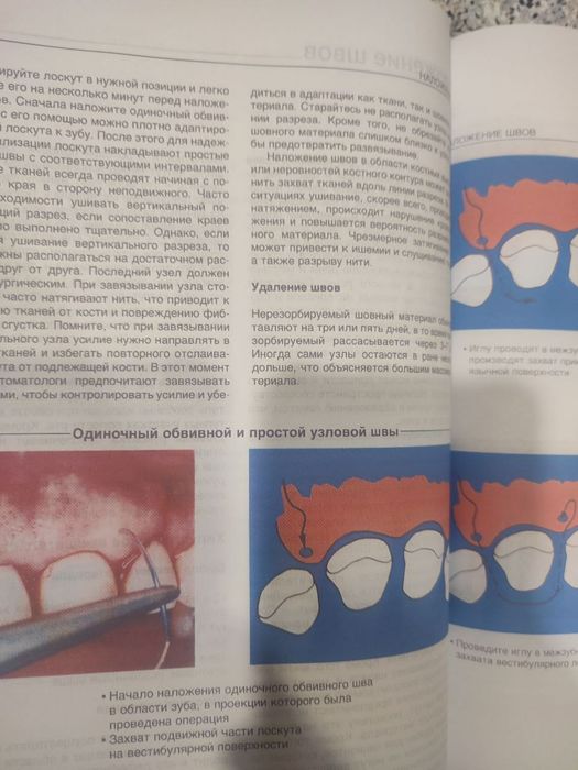 Клинический атлас эндодонтической хирургии. Стоматология эндодонтия